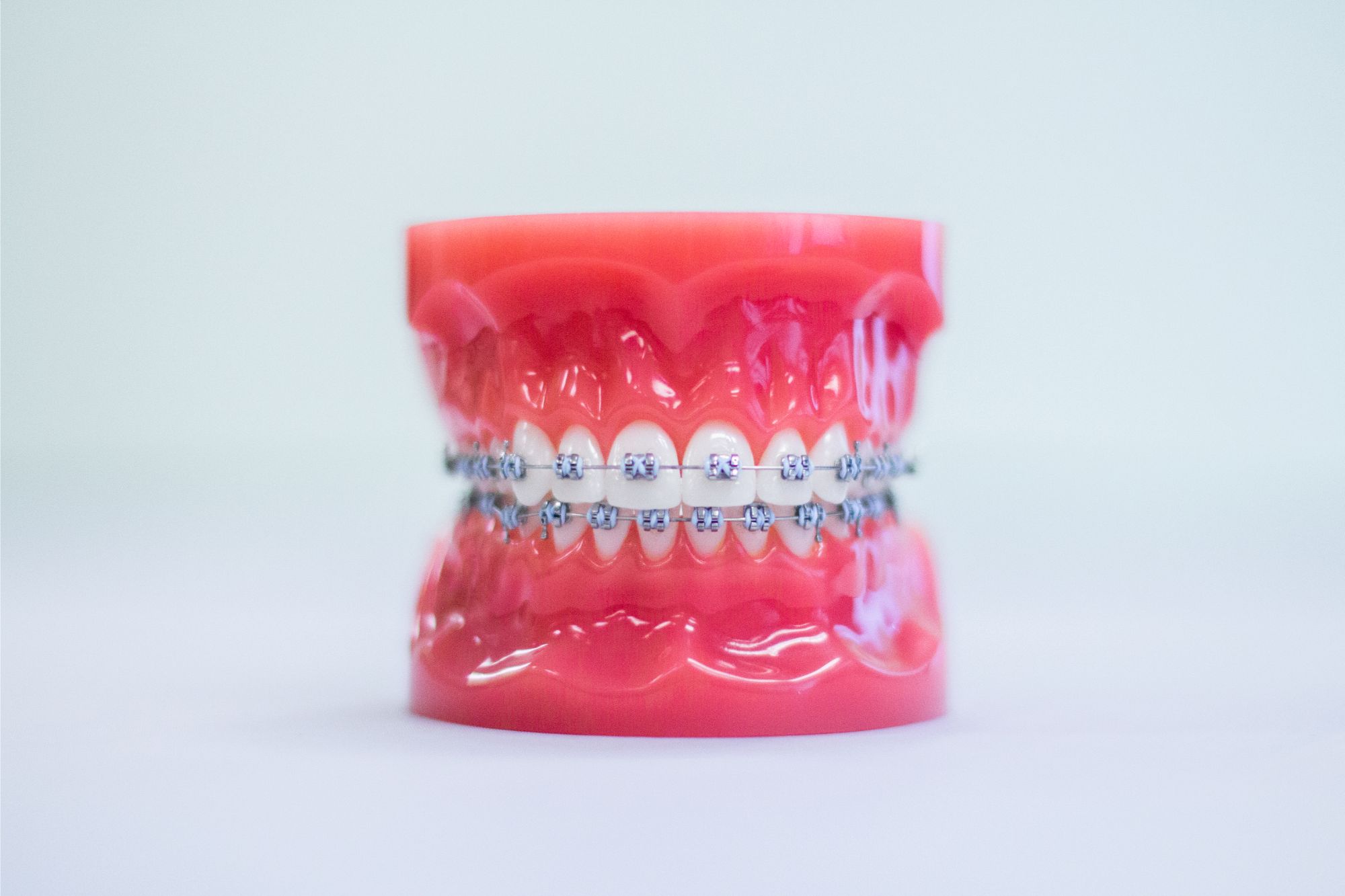 Clear Ceramic  Orthodontist in Utah County, UT